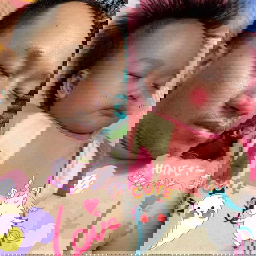 แฝดยิ่งกว่าแฝด