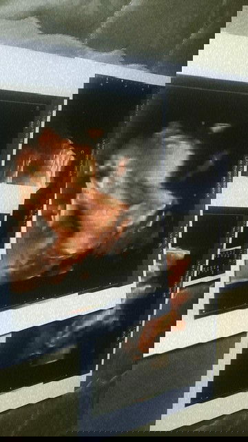 Usg di kehamilan 37 minggu