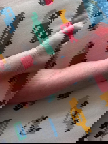 Bintik merah dekat badan baby