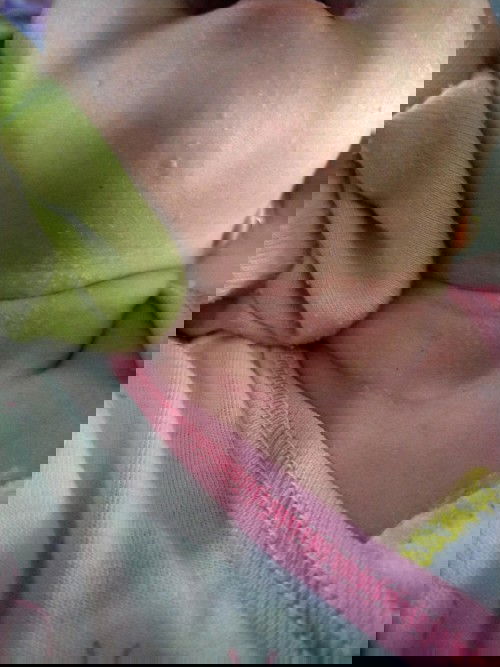 Biang keringat pada bayi