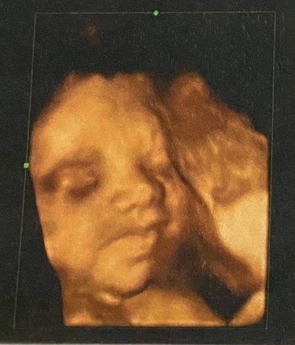 สอบถามเรื่องน้ำหนักตัวน้องค่ะ🙏