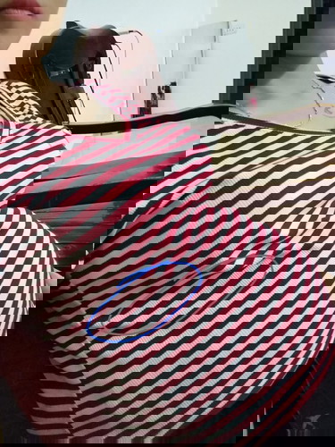 Các m cho e hỏi có mom nào tự nhiên bị đau nhói ở vị trí e đánh dấu k ạ.đau quá cười cho đỡ đau luôn