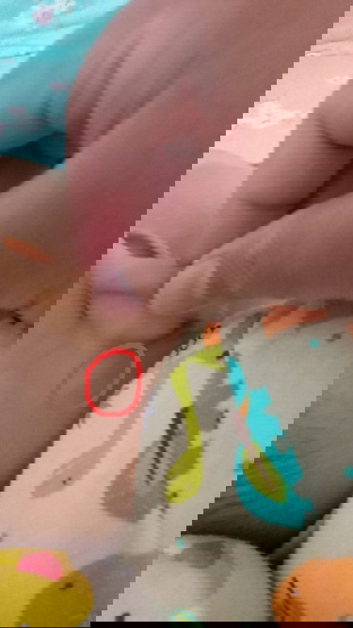 Benjolan  di belakang telinga