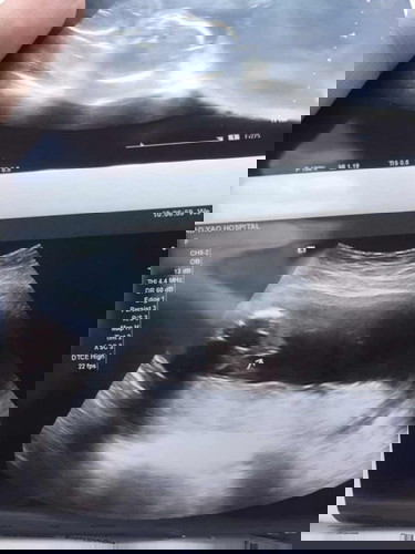 แม่ๆคนไหนดูเป็นมั้งค่ะ