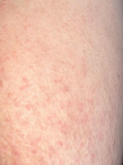 Sharing penyakit yang muncul ditrimester 3