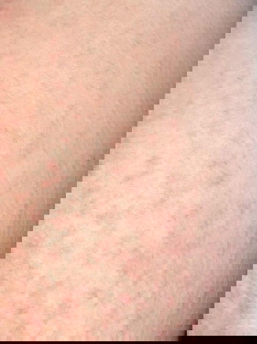 Sharing penyakit yang muncul ditrimester 3