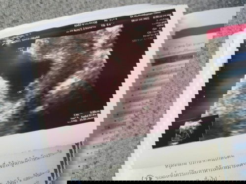 หนูมากับคำว่า IUI💙