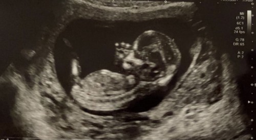 Gender guess