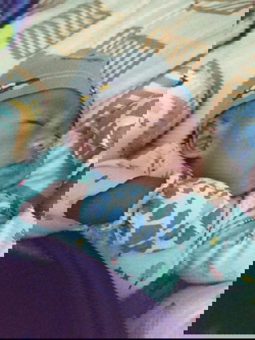 Kulit wajah bayi tidak merata