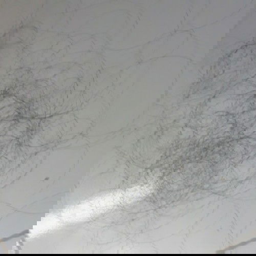 Rambut rontok usai melahirkan