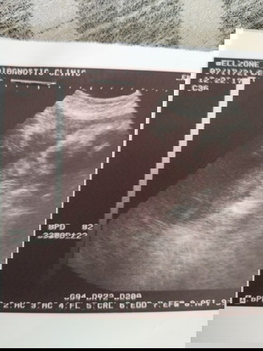 ultrasound