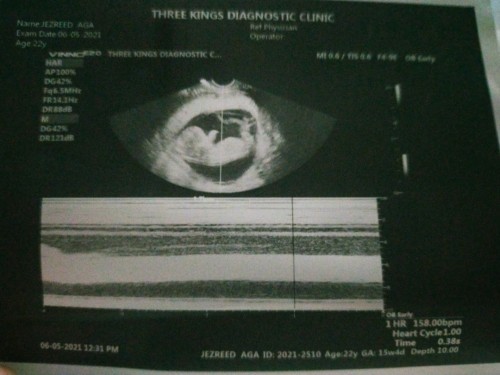 My ultrasound - 12weeks and 5days