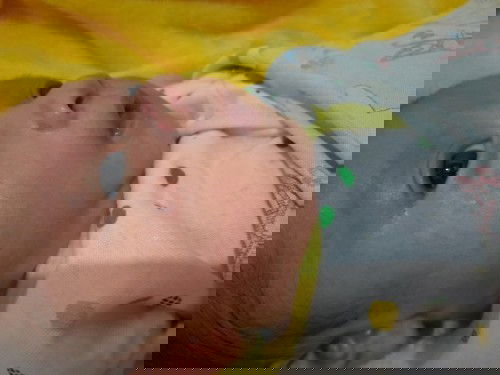 Cara mengatasi Ruam susu bayi