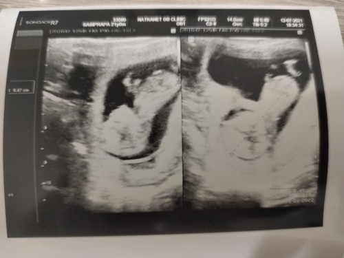 ซาวครั้งแรก 12W
ตอนนี้14Wแล้ว😍😍😍