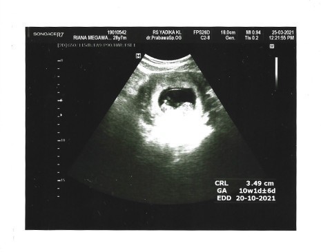 Akhirnya Hamil! Setelah Hampir 3 Tahun Penantian