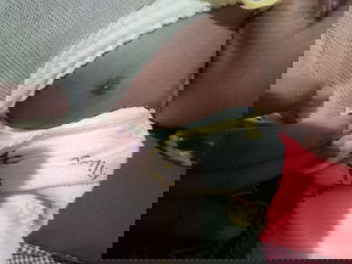 Bintik putih di puting bayi apakah bahaya ?