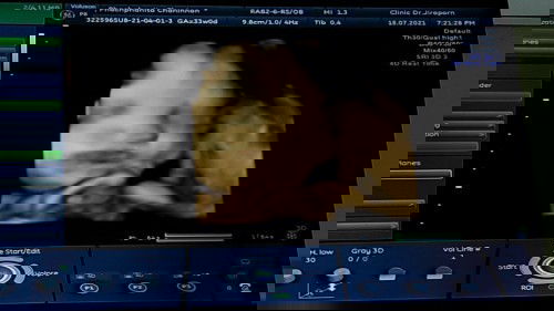 บันทึกลูกรัก 33วีค❤