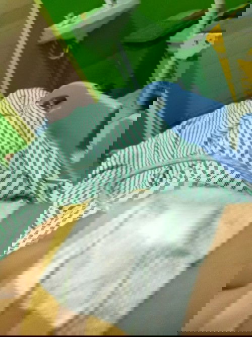 Induksi karna lewat hpl