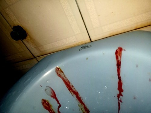 ถ่ายเป็นเลือด