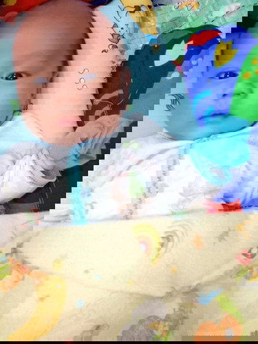 Mau tnya donk
Bnjoln di payudra bayi usia 3minggu,itu kira2 knpa yh?
Bgaimna cara menghilngknnya?