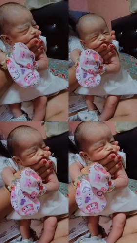 ผ่าคลอดเเล้ว