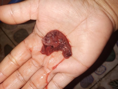 สงสัยรบกวนถาม