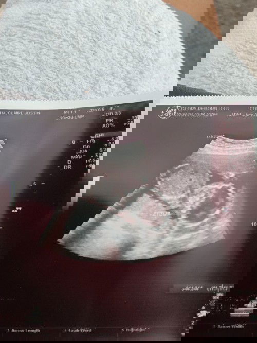 Ultrasound Result