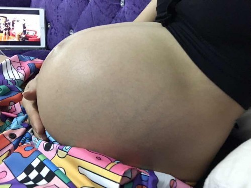 33 week ท้องแข็งทุกๆ 5 นาที มีตกขาวสีเหลืองขุ่น ต้องรีบไปพบแพทย์ทันที