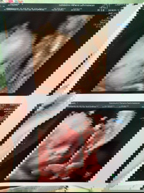 Sebentar lagi hpl tgl 11 agust 2021 tapi pas usg bbj udh 2,8kg alhasil suruh diet nasi haha