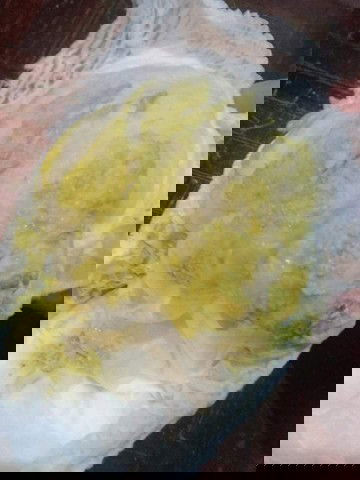 ลูกเรา10เดือน15วันท้องเสียวันแรกพาไปหาหมอผ่านมา4วันถ่ายมีเลือดออกแบบนี้มีลูกไคเป็นบางคะไปหาหมอไหม