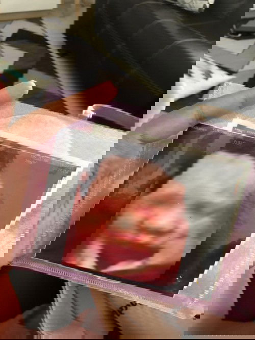 Baby terbeli tali pusat #28w3d 😞