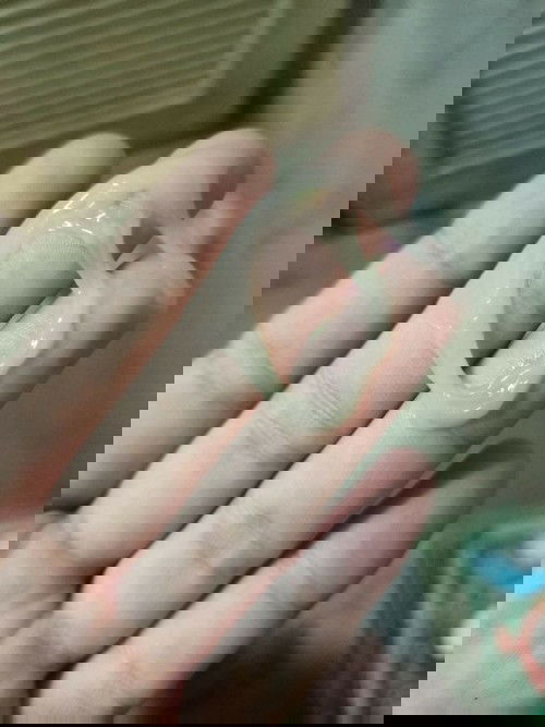 สอบถามแม่ๆคะว่ามีแบบนี้ออกคืออะไรคะ ท้องได้ 34Week แล้วคะมีมูกแบบนี้ออกแต่ไม่มีอาการเจ็บท้องหรืออะไร