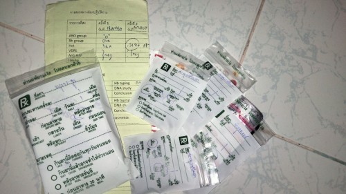 ค่าเลือดลดลง