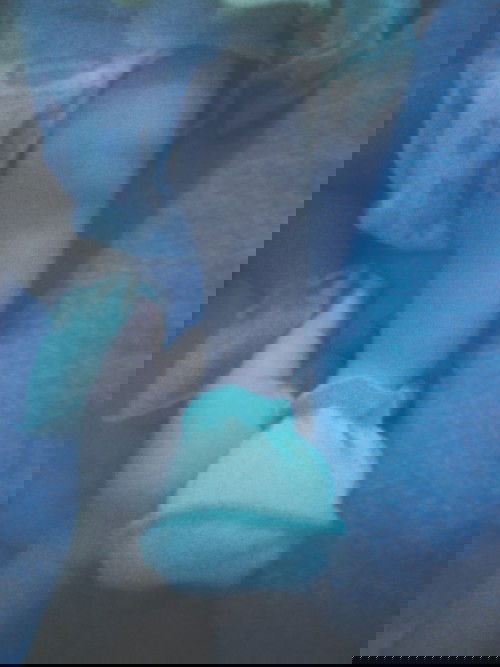 . Mấy mom cho em hỏi chân con em vầy phải bị cong k ạ