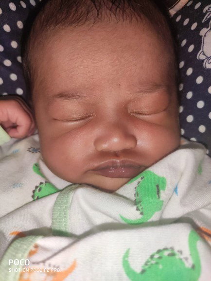Ada Tips mencerahkan bibir bayi?