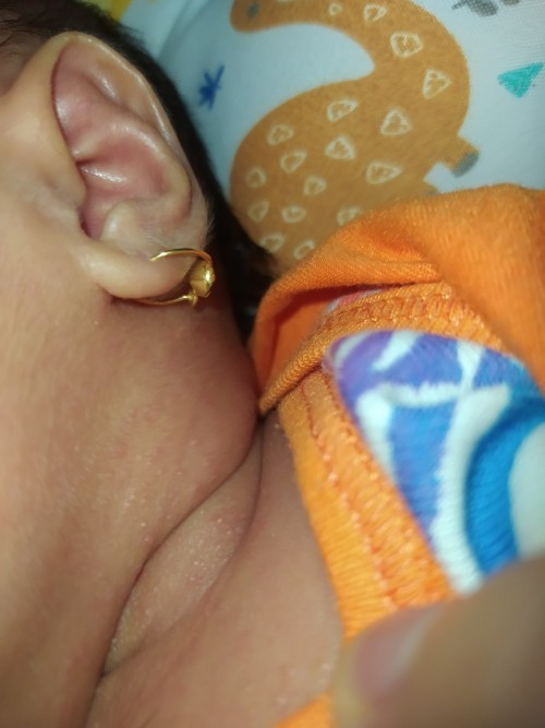 Obat luar untuk bayi