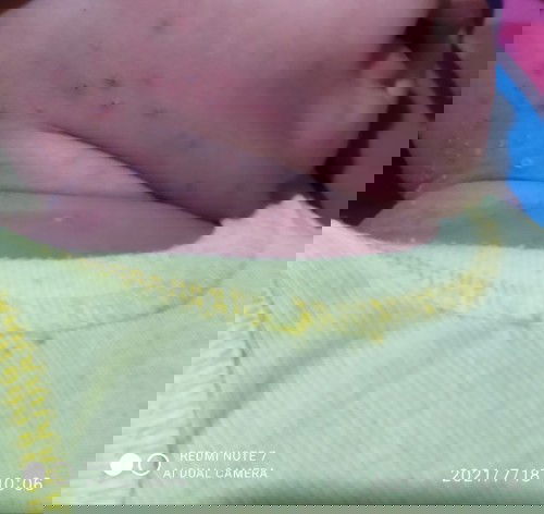 bintik bintik berair