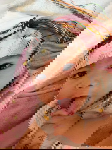 gayat pada bayi 11bulan