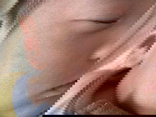 ผื่นที่หน้าทารก อันตรายไหมเกิดจากอะไร