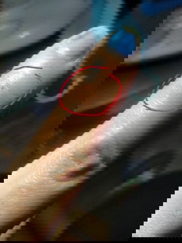 Pwede poh ba mag pa inject ng anti rabies ang buntis? Im 31 weeks pregnant poh,tuta ko naman po yun.