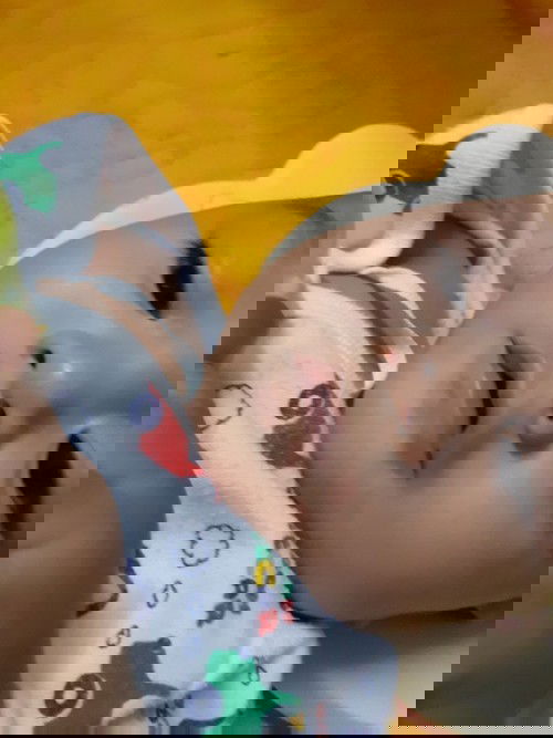 อยากรู้อาการว่าแพ้นมหรือป่าว