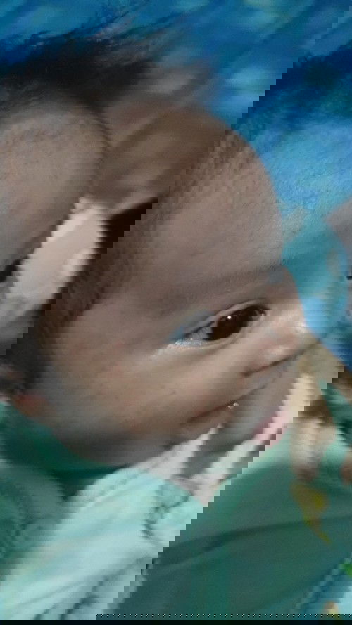 Bintik merah di muka bayi