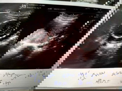 ขอสอบถามแม่ๆหน่อยค่ะ