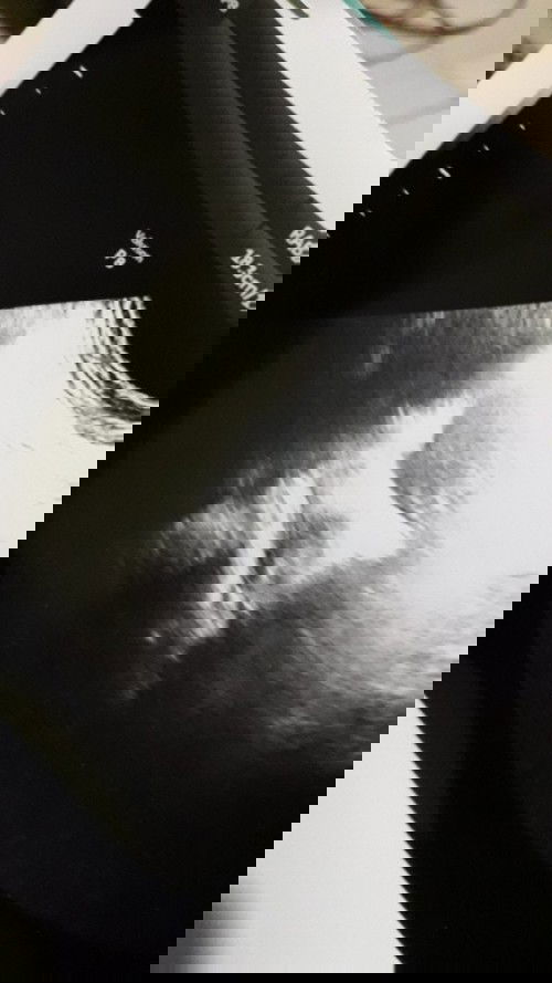 Tespeck positif jadi negatif