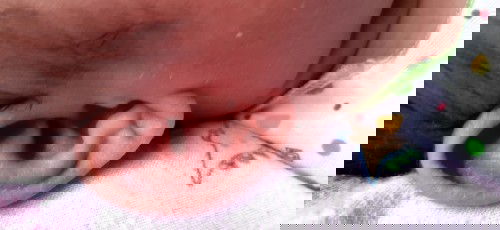 Bun adakah yang pernah mengalami daun telinga pada bayi sering basah dan kemerahan?