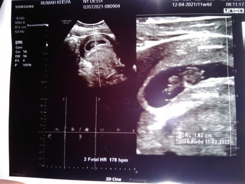 Sulit tidur dan badan terasa tidak nyaman