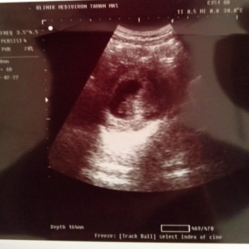 First baby