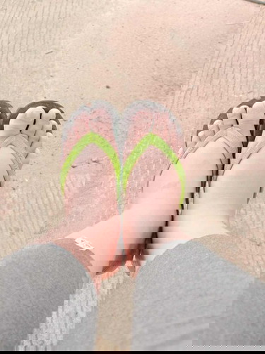 7เดือนแล้ว เท้าบวมมาก