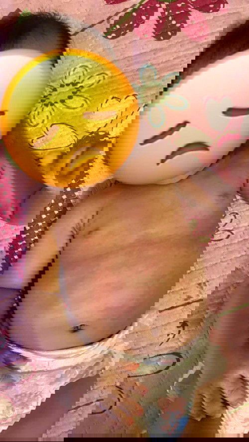 Baby rash all over body and head