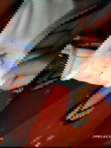 Brown wet discharge